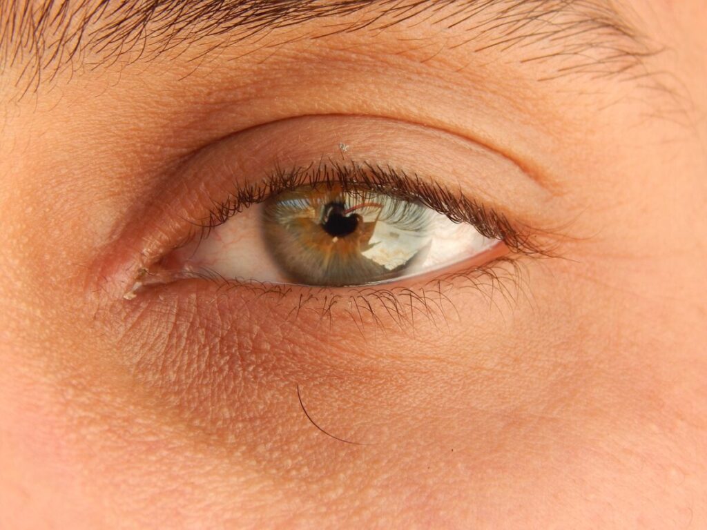 Biorivitalizzazione occhi: il trattamento delicato che riaccende lo sguardo